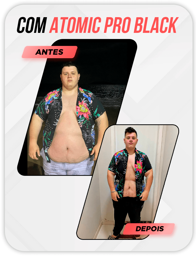 Novo-Antes-e-DepoisMateus-30KG.png