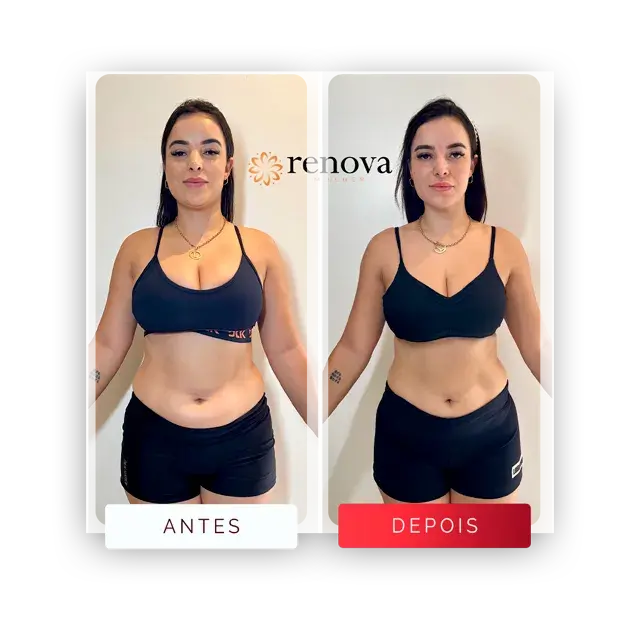 Prancheta-14-copiar-2-Media.webp