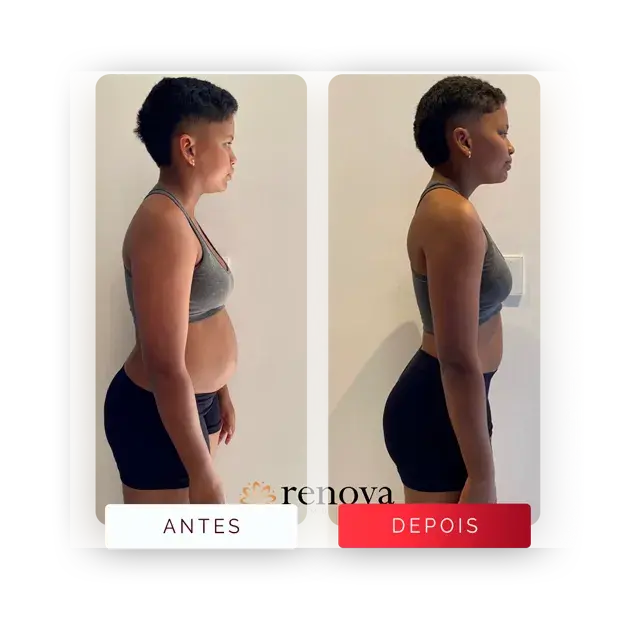 Prancheta-14-copiar-3-1-Media.webp
